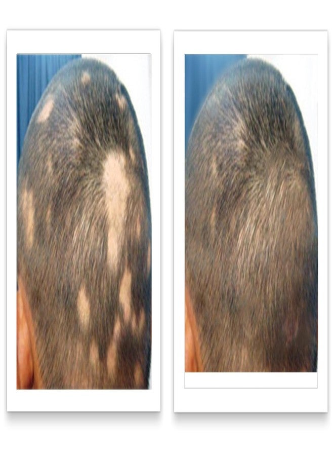 Caboki 10X Hair Powder for Thinning Hair, Light Brown - For Men & Women, TALC-Free, Healthful Formula, Instantly Fuller Hair, Flawless Roots, Rain and Sweat Resistant, Easy to Use - Image 4